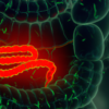 Enfermedad inflamatoria intestinal (EII): Síntomas, complicaciones y tratamientos en México