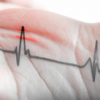 Hipertensión arterial: una enfermedad crónica en México