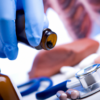 Hepatitis: Causas, síntomas y tratamiento en México